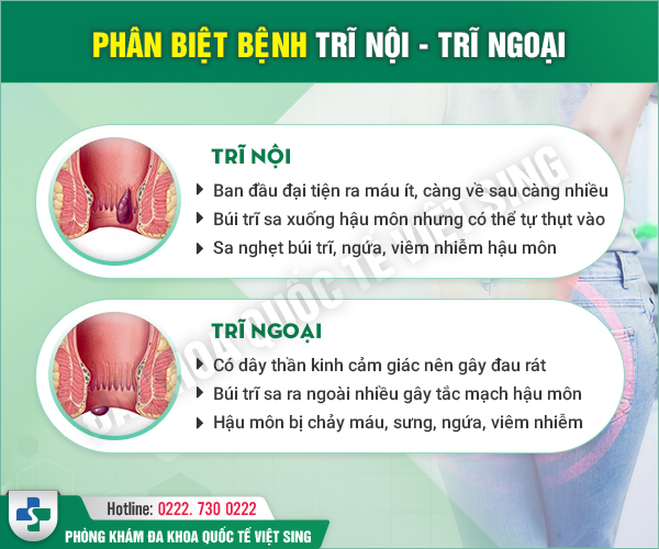 Phân biệt ngay trĩ nội và trĩ ngoại để tránh những biến chứng nguy hiểm