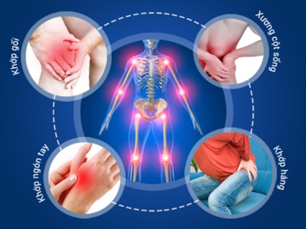 Top 5 địa chỉ khám xương khớp tốt nhất tại Bắc Ninh 2026: Bác sĩ giỏi, điều trị hiệu quả