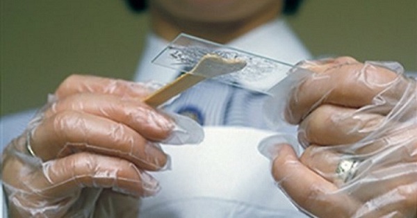 Xét nghiệm phụ khoa sớm: Cách đơn giản phòng tránh viêm nhiễm và vô sinh