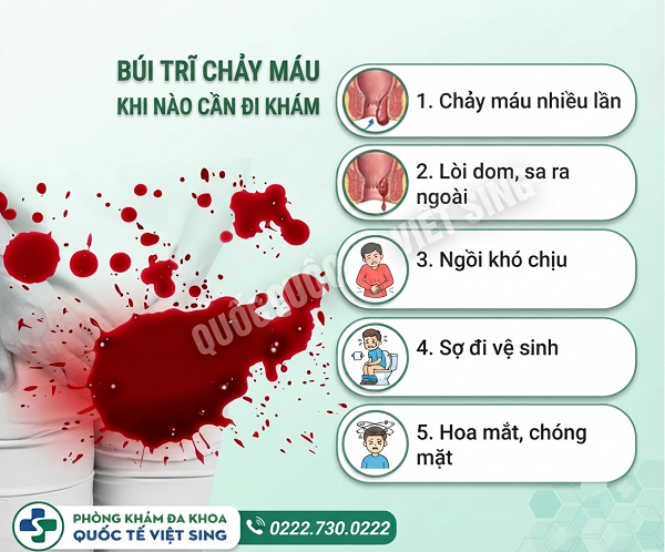 Búi trĩ chảy máu – Giai đoạn cấp tính không được bỏ qua