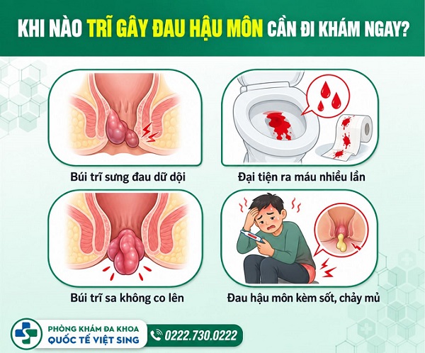 Trĩ gây đau hậu môn: Khi nào cần đi khám ngay?